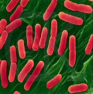 CMCC大肠杆菌表皮葡萄球菌肺炎克雷伯菌枯草芽孢杆菌价格图片