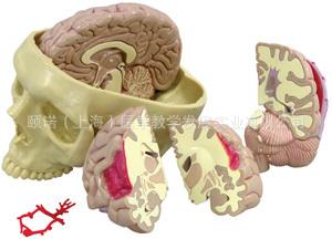 颅骨脑解剖结构批发