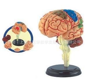 4D 脑模型 4D master 益智玩具 人体拼装模型 大脑解剖结图片