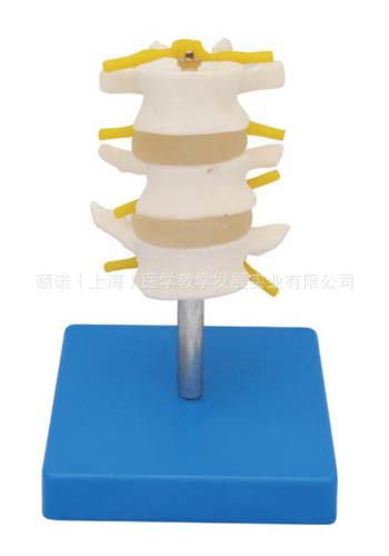 供应腰椎组合(3节)腰椎椎间盘模型