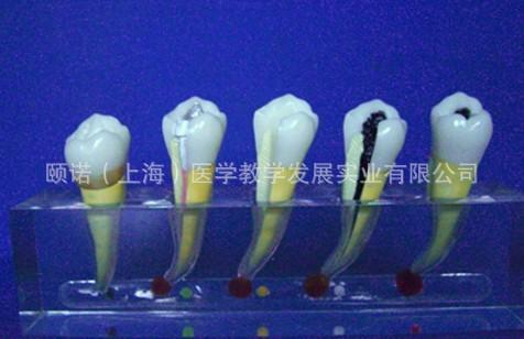 供应牙体牙髓病临床模型B