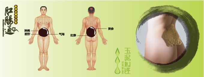 供应玉泥心经泥灸“肛肠通”