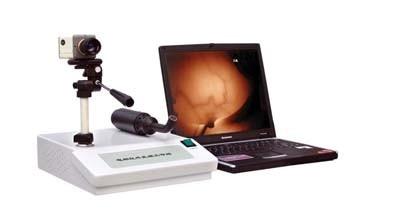 供应推车式红外乳腺诊断仪图片