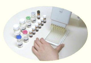 人可溶性瘦素受体ELISA试剂盒供应人可溶性瘦素受体ELISA试剂盒