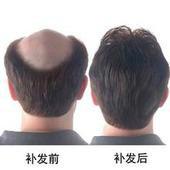 供应沧州泊头专业定做高端假发发片发块，泊头定制女士高端假发发片发块。