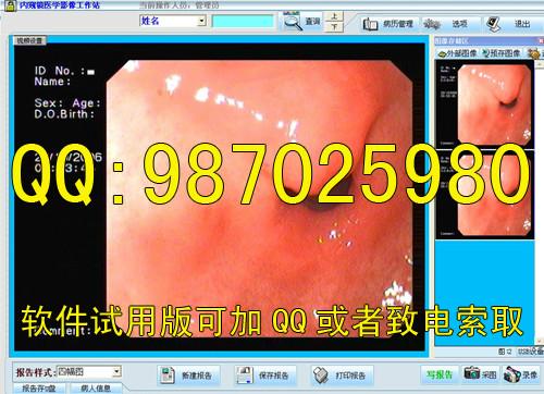 供应口腔镜影像工作站口腔科图文报告口腔科工作站软件图片