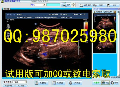 彩超软件彩超工作站软件WIN7版批发