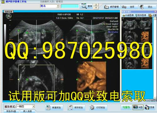 B超工作站软件B超软件彩超通用版批发