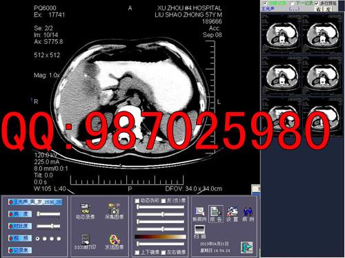 CT工作站CT软件CT模拟转数字批发