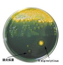 供应肠炎弧菌用TCBS琼脂培养基
